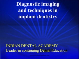 Diagnostic imaging
and techniques in
implant dentistry
INDIAN DENTAL ACADEMY
Leader in continuing Dental Education
www.indiandentalacademy.com
 