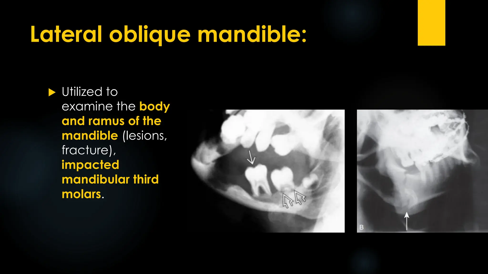 Diagnostic Imaging in Oral and Maxillofacial Surgery | PDF