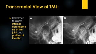 Tmj Radiograph Positioning Diagnostic Imaging in Oral and Maxillofacial Surgery | PDF