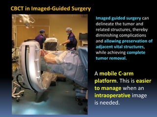 CBCT in Imaged-Guided Surgery
Imaged guided surgery can
delineate the tumor and
related structures, thereby
diminishing complications
and allowing preservation of
adjacent vital structures,
while achieving complete
tumor removal.

A mobile C-arm
platform. This is easier
to manage when an
intraoperative image
is needed.

 