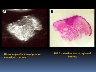Ultrasonographic scan of gelatinembedded specimen

H & E stained section of region of
interest

 