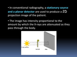 • In conventional radiography, a stationary source
and a planar detector are used to produce a 2D
projection image of the patient.
• The image has intensity proportional to the
amount by which the X-rays are attenuated as they
pass through the body.

 