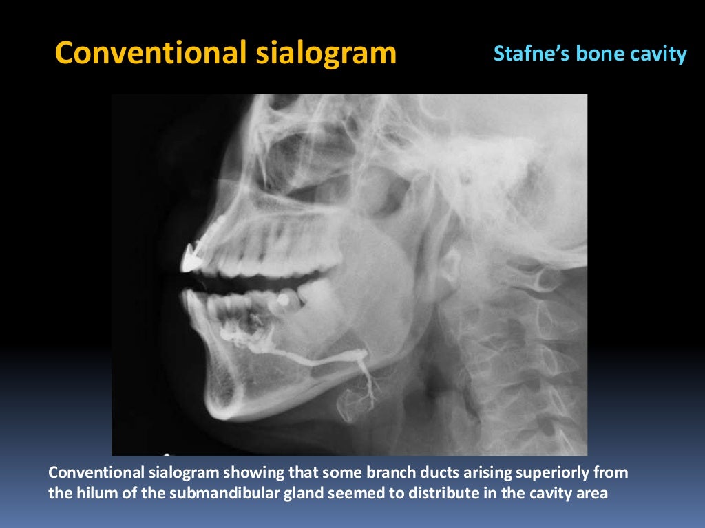 Diagnostic imaging in head and neck pathology