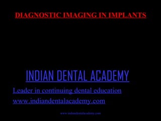 DIAGNOSTIC IMAGING IN IMPLANTS

INDIAN DENTAL ACADEMY
Leader in continuing dental education
www.indiandentalacademy.com
www.indiandentalacademy.com

 