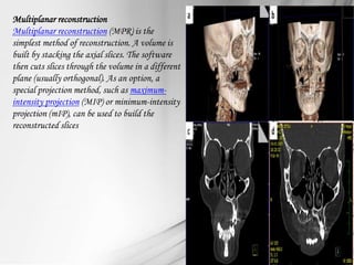 diagnosticimaginginoromaxillofacialsurgery-141214161540-conversion ...