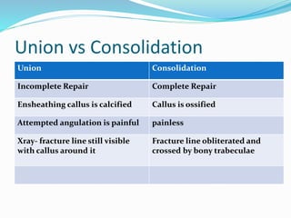 Union vs Consolidation
Union Consolidation
Incomplete Repair Complete Repair
Ensheathing callus is calcified Callus is ossified
Attempted angulation is painful painless
Xray- fracture line still visible
with callus around it
Fracture line obliterated and
crossed by bony trabeculae
 