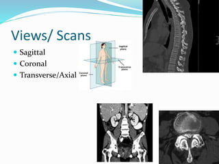 Views/ Scans
 Sagittal
 Coronal
 Transverse/Axial
 