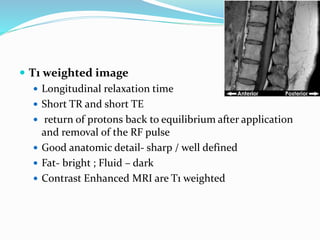  T1 weighted image
 Longitudinal relaxation time
 Short TR and short TE
 return of protons back to equilibrium after application
and removal of the RF pulse
 Good anatomic detail- sharp / well defined
 Fat- bright ; Fluid – dark
 Contrast Enhanced MRI are T1 weighted
 