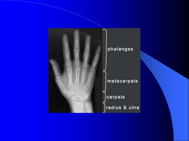 Diagnostic Imaging of Bones and Joints.ppt | Bone and Joint Conditions ...