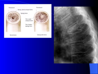 Diagnostic Imaging of Bones and Joints.ppt