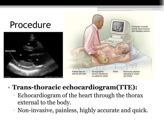 Diagnostic Investigations of Cardiovascular System | PPTX