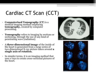 Diagnostic Investigations of Cardiovascular System | PPTX
