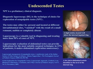 Undescended Testes NPT is a preliminary clinical diagnosis. Diagnostic laparoscopy (DL) is the technique of choice for exploration of nonpalpable testes (NPT) . The testes may either be: present and located at different intraabdominal sites, “vanished” with the result of a small remnant, nubbin or completely absent. Laparoscopy is a valuable tool in diagnosing and treating more than 50% of cases of NPT.  Laparoscopic evaluation of abdominal testes can provide indications for the most suitable surgical technique; in 23% of patients, it makes abdominal exploration unnecessary. Laparoscopic management of nonpalpable testes: A multicenter study of the Italian Society of Video Surgery in Infancy. Alfonso Papparellaa,*, Pio Parmeggiani  Journal of Pediatric Surgery  (2005) 40, 696-700. Groin Exploration for Nonpalpable Testes: Laparoscopic Approach. J Schleef, S von Bismarck, K Burmucic, A Gutmann, and J Mayr  Journal of Pediatric Surgery,  Vol 37, No 11 (November), 2002: A high testicle, located well above the internal inguinal ring. A low intra-abdominal testicle identified at the level of the internal ring 