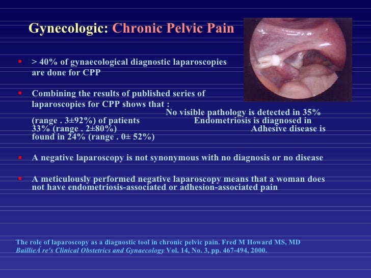 Diagnostic Laparoscopy for Pelvic Disorders