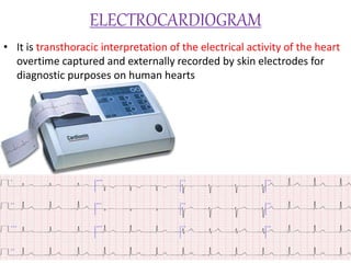 ELECTROCARDIOGRAM
• It is transthoracic interpretation of the electrical activity of the heart
overtime captured and externally recorded by skin electrodes for
diagnostic purposes on human hearts
 