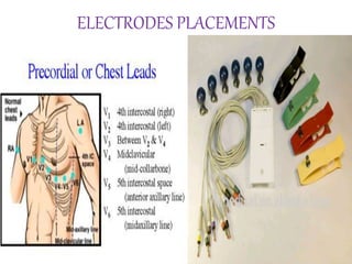 ELECTRODES PLACEMENTS
 