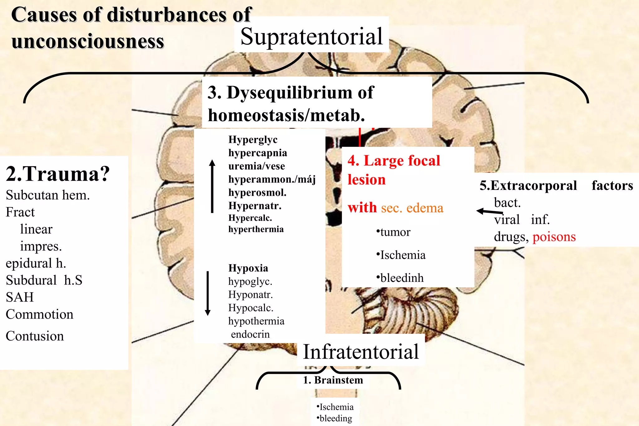 1. Brainstem Hyperglyc hypercapnia uremia/vese hyperammon./máj hyperosmol. Hypernatr. Hypercalc. hyperthermia Hypoxia hypoglyc. Hyponatr. Hypocalc. hypothermia endocrin 5.Extracorporal  factors bact.  viral  inf. drugs,  poisons Ischemia bleeding 2.Trauma? Subcutan hem. Fract linear impres. epidural h.  Subdural  h.S SAH  Commotion  Contusion  (SAH)   4. Large focal lesion with   sec. edema tumor Ischemia bleedinh 3. Dysequilibrium of homeostasis/metab. Supratentorial Infratentorial Causes of disturbances of unconsciousness 