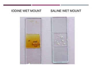IODINE WET MOUNT SALINE WET MOUNT
 