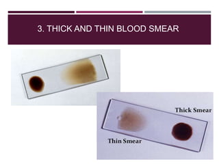 3. THICK AND THIN BLOOD SMEAR
 
