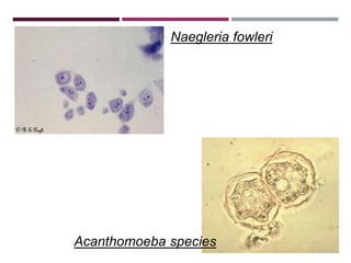 Naegleria fowleri
Acanthomoeba species
 