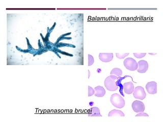 Balamuthia mandrillaris
Trypanasoma brucei
 