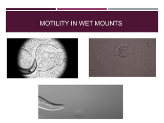 MOTILITY IN WET MOUNTS
 