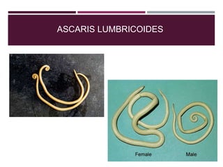 ASCARIS LUMBRICOIDES
 