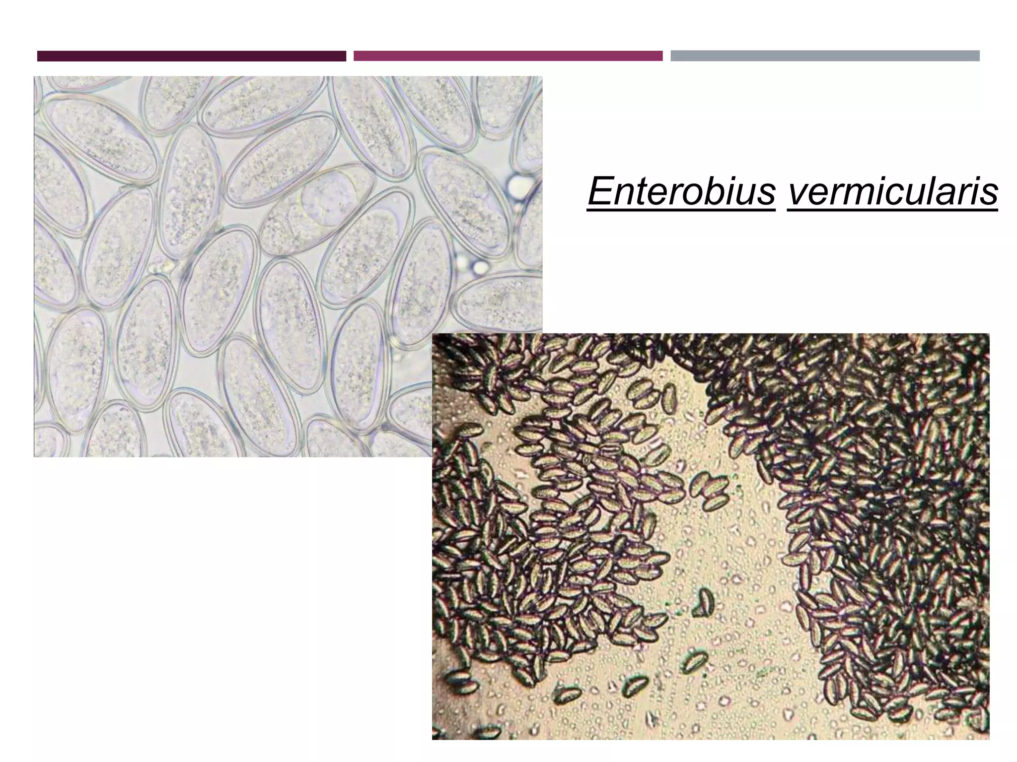 Enterobius vermicularis
 