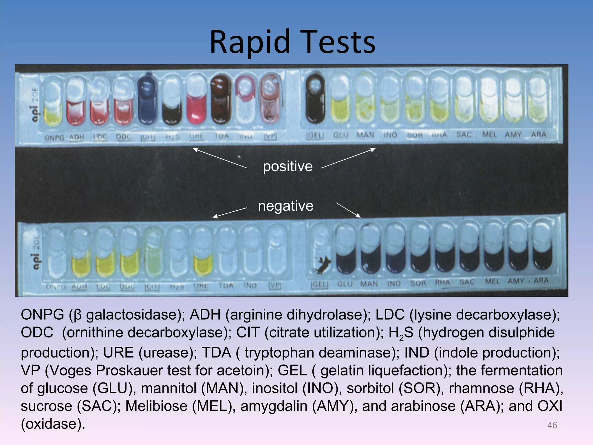 Rapid Tests  ONPG ( β  galactosidase); ADH (arginine dihydrolase); LDC (lysine decarboxylase); ODC  (ornithine decarboxylase); CIT (citrate utilization); H 2 S (hydrogen disulphide production); URE (urease); TDA ( tryptophan deaminase); IND (indole production); VP (Voges Proskauer test for acetoin); GEL ( gelatin liquefaction); the fermentation of glucose (GLU), mannitol (MAN), inositol (INO), sorbitol (SOR), rhamnose (RHA), sucrose (SAC); Melibiose (MEL), amygdalin (AMY), and arabinose (ARA); and OXI (oxidase). positive negative 