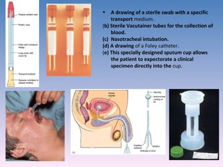 A drawing of a sterile swab with a specific transport  medium.  ( b) Sterile Vacutainer tubes for the collection of blood.  (c)  Nasotracheal intubation.  (d) A drawing  of a Foley catheter.  ( e) This specially designed sputum cup allows the patient to expectorate a clinical specimen directly into the  cup.  