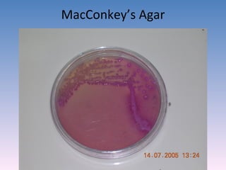 MacConkey’s Agar 