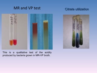 MR and VP test This is a qualitative test of the acidity produced by bacteria grown in MR-VP broth. Citrate utilization 