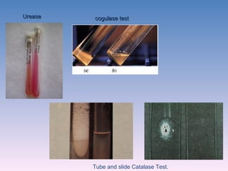 cogulase test Urease Tube and slide Catalase Test. 