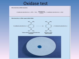 Oxidase test 