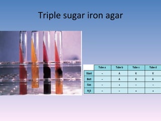 Triple sugar iron agar 