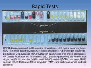 Rapid Tests  ONPG ( β  galactosidase); ADH (arginine dihydrolase); LDC (lysine decarboxylase); ODC  (ornithine decarboxylase); CIT (citrate utilization); H 2 S (hydrogen disulphide production); URE (urease); TDA ( tryptophan deaminase); IND (indole production); VP (Voges Proskauer test for acetoin); GEL ( gelatin liquefaction); the fermentation of glucose (GLU), mannitol (MAN), inositol (INO), sorbitol (SOR), rhamnose (RHA), sucrose (SAC); Melibiose (MEL), amygdalin (AMY), and arabinose (ARA); and OXI (oxidase). positive negative 