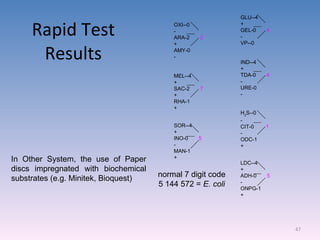 Rapid Test Results In Other System, the use of Paper discs impregnated with biochemical substrates (e.g. Minitek, Bioquest)  OXI--0 - ARA-2  2 + AMY-0 - MEL--4 + SAC-2  7 + RHA-1 + SOR--4 + INO-0  5 - MAN-1 + GLU--4 + GEL-0  4 - VP--0 IND--4 + TDA-0  4 - URE-0 - H 2 S--0 - CIT-0  1 - ODC-1 + LDC--4 + ADH-0  5 - ONPG-1 + normal 7 digit code 5 144 572 =  E. coli 