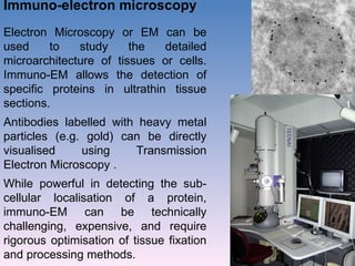 Immuno-electron microscopy Electron Microscopy or EM can be used to study the detailed microarchitecture of tissues or cells. Immuno-EM allows the detection of specific proteins in ultrathin tissue sections.  Antibodies labelled with heavy metal particles (e.g. gold) can be directly visualised using Transmission Electron Microscopy .  While powerful in detecting the sub-cellular localisation of a protein, immuno-EM can be technically challenging, expensive, and require rigorous optimisation of tissue fixation and processing methods. 