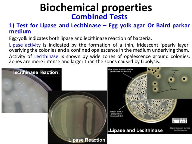 of bacteria properties e.coli Microbiology  Modern Diagnostic Traditional and  Medical