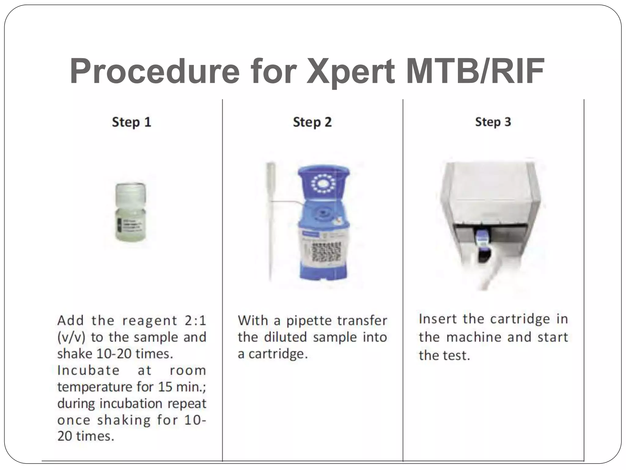 Procedure for Xpert MTB/RIF
 