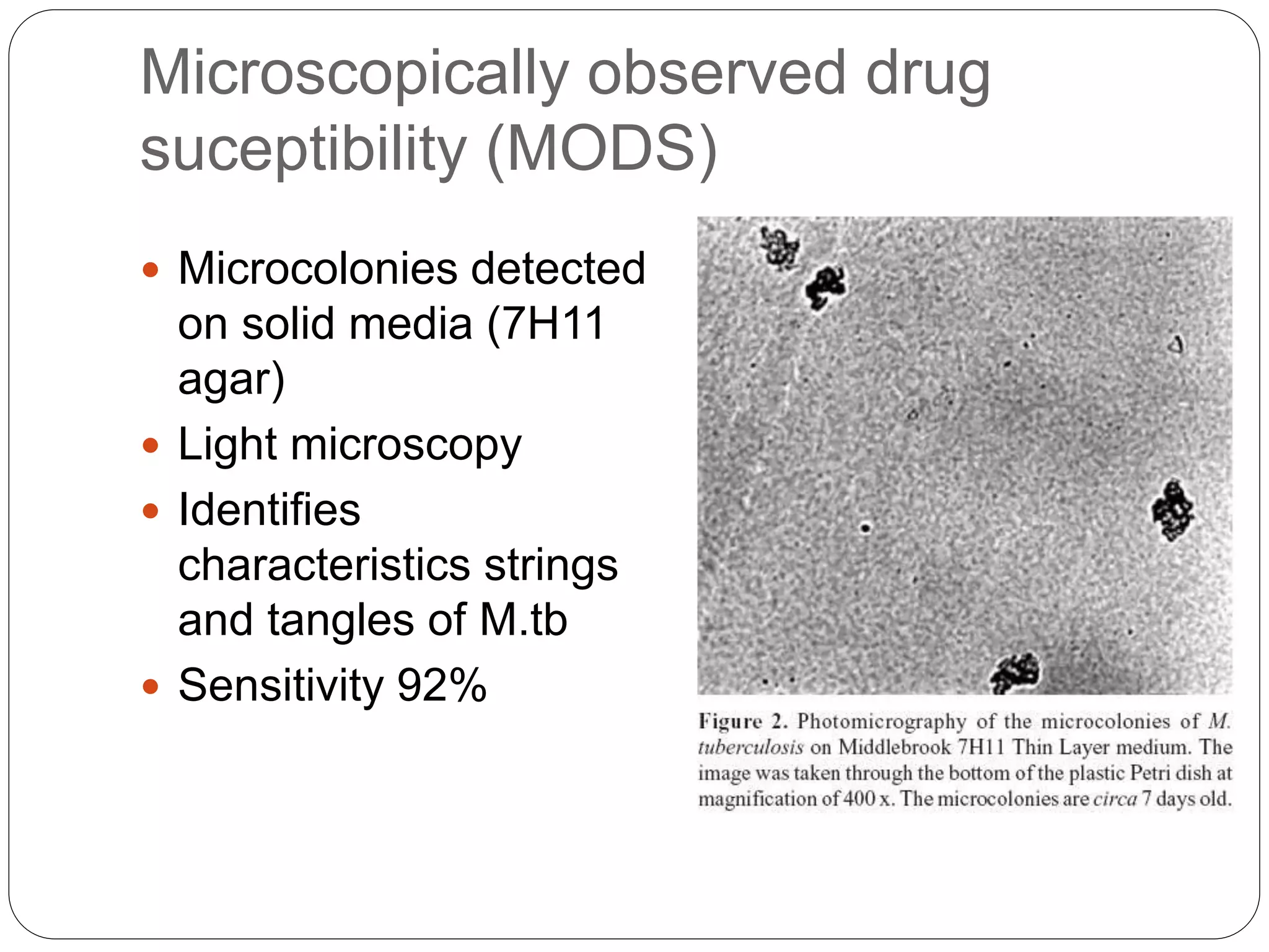 Microscopically observed drug
suceptibility (MODS)
 Microcolonies detected
on solid media (7H11
agar)
 Light microscopy
 Identifies
characteristics strings
and tangles of M.tb
 Sensitivity 92%
 