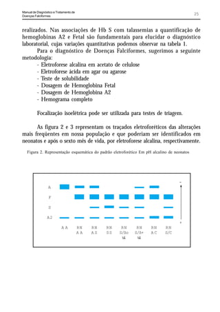 Manual de Diagnóstico e Tratamento de
Doenças Falciformes
                                                                                             25


realizados. Nas associações de Hb S com talassemias a quantificação de
hemoglobinas A2 e Fetal são fundamentais para elucidar o diagnóstico
laboratorial, cujas variações quantitativas podemos observar na tabela 1.
       Para o diagnóstico de Doenças Falciformes, sugerimos a seguinte
metodologia:
       - Eletroforese alcalina em acetato de celulose
       - Eletroforese ácida em agar ou agarose
       - Teste de solubilidade
       - Dosagem de Hemoglobina Fetal
       - Dosagem de Hemoglobina A2
       - Hemograma completo

          Focalização isoelétrica pode ser utilizada para testes de triagem.

      As figura 2 e 3 representam os traçados eletroforéticos das alterações
mais freqüentes em nossa população e que poderiam ser identificados em
neonatos e após o sexto mês de vida, por eletroforese alcalina, respectivamente.
   Figura 2. Representação esquemática do padrão eletroforético Em pH alcalino de neonatos




                                                                                    -
                  A

                  F

                  S

                 A2
                                                                                    +
                           AA           RN   RN   RN    RN     RN    RN      RN
                                        AA   AS   SS   S/ßo   S/ß+   AC      S/C
                                                        tl
                                                         a     tl
                                                                a
 