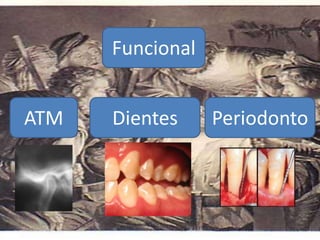 Funcional
ATM Dientes Periodonto
 