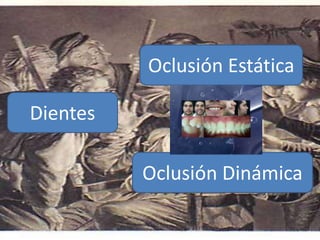 Dientes
Oclusión Estática
Oclusión Dinámica
 