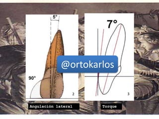 2 3
Angulación lateral Torque
@ortokarlos
 