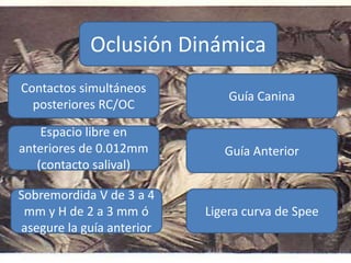Oclusión Dinámica
Contactos simultáneos
posteriores RC/OC
Espacio libre en
anteriores de 0.012mm
(contacto salival)
Sobremordida V de 3 a 4
mm y H de 2 a 3 mm ó
asegure la guía anterior
Guía Canina
Guía Anterior
Ligera curva de Spee
 