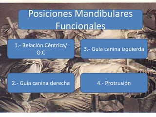 Posiciones Mandibulares
Funcionales
1.- Relación Céntrica/
O.C
2.- Guía canina derecha 4.- Protrusión
3.- Guía canina izquierda
 