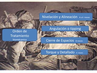 Orden de
Tratamiento
biomécanica
Nivelación y Alineación 4 a 6 meses
Angulación o tipping
Cierre de Espacios 8 meses
Torque y Detallado 6 meses
 