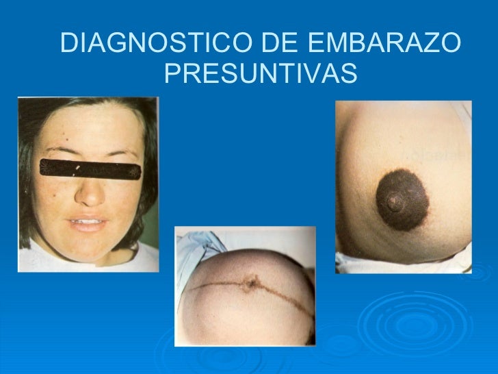 La várice varicosa en los pies el tratamiento en spb