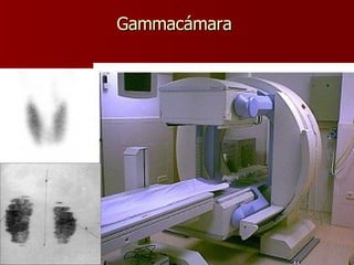 Gammacámara   